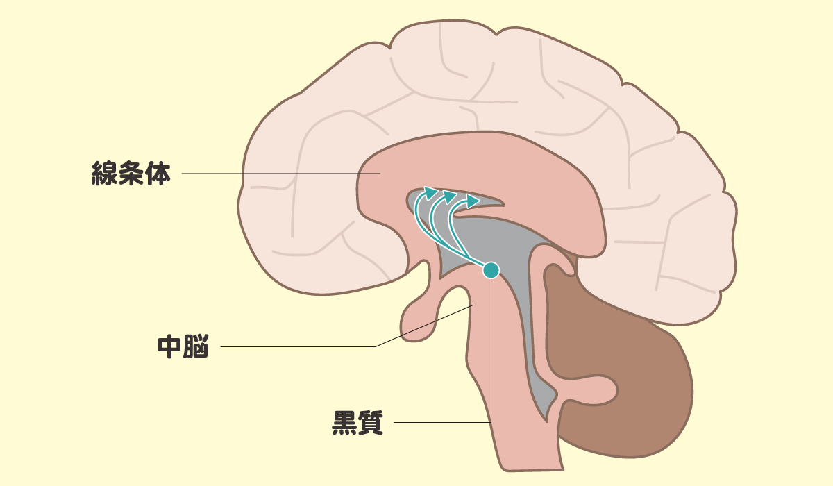 パーキンソン病患者の脳内で注目すべき箇所（線条体、中脳、黒質）を図解で見える化